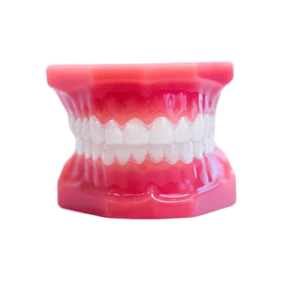 Clear Aligners