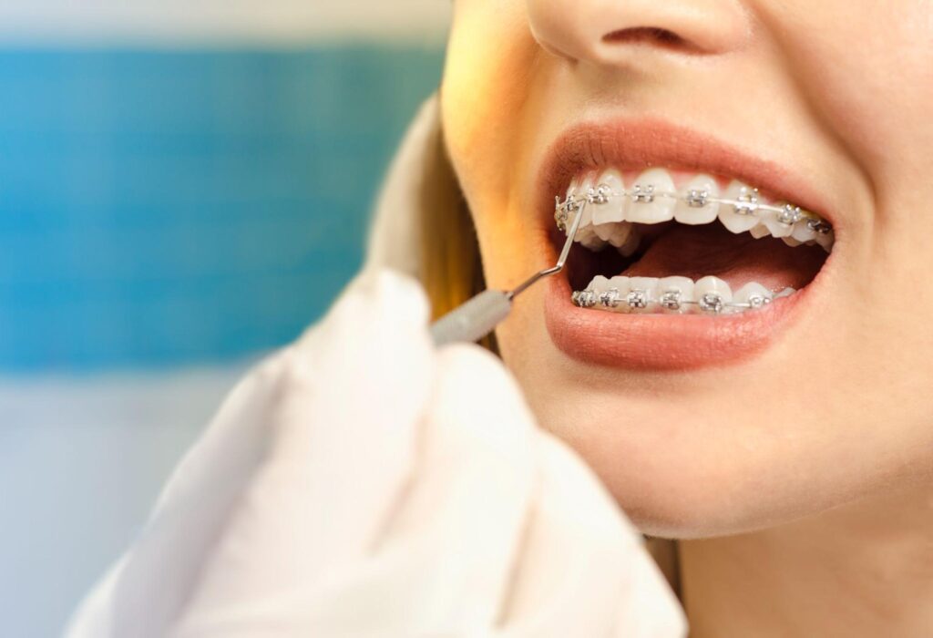 The Best Age To Start Orthodontic Treatment In Sanford