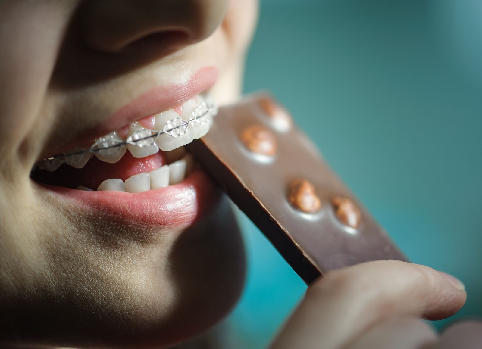 5 Foods To Avoid With Braces In Bayboro