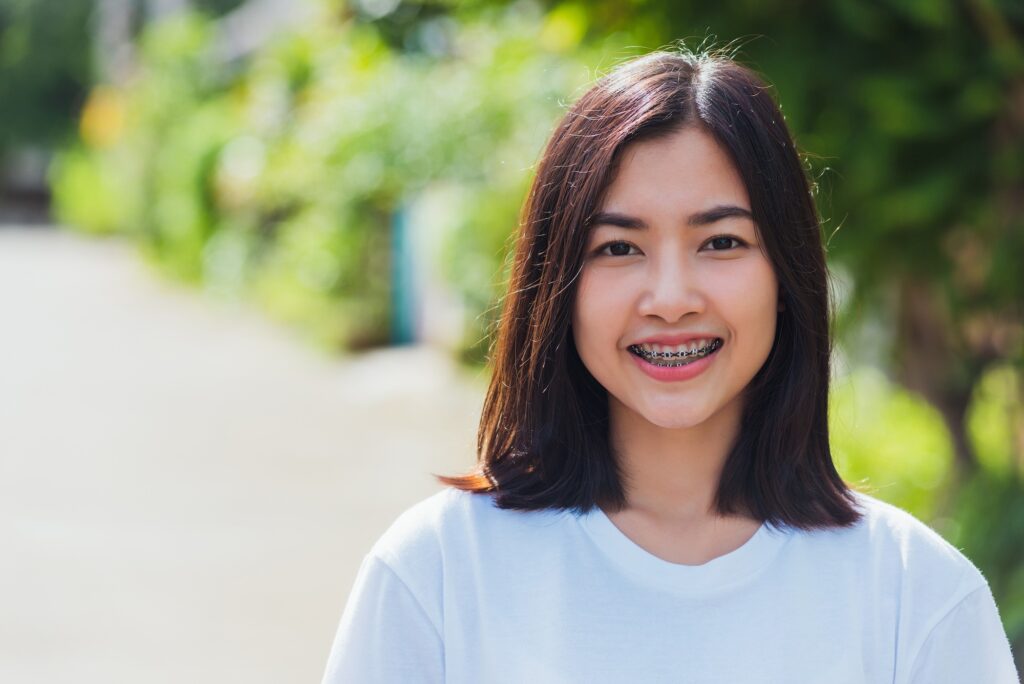 How Long Do I Need to Wear My Retainer?